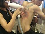 Лазер монализа для удаления тату татуажа и карбонового пилинга с завода пекина - photo 3