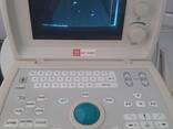 Ультразвуковой сканер Mindray DP 1100 - фото 3